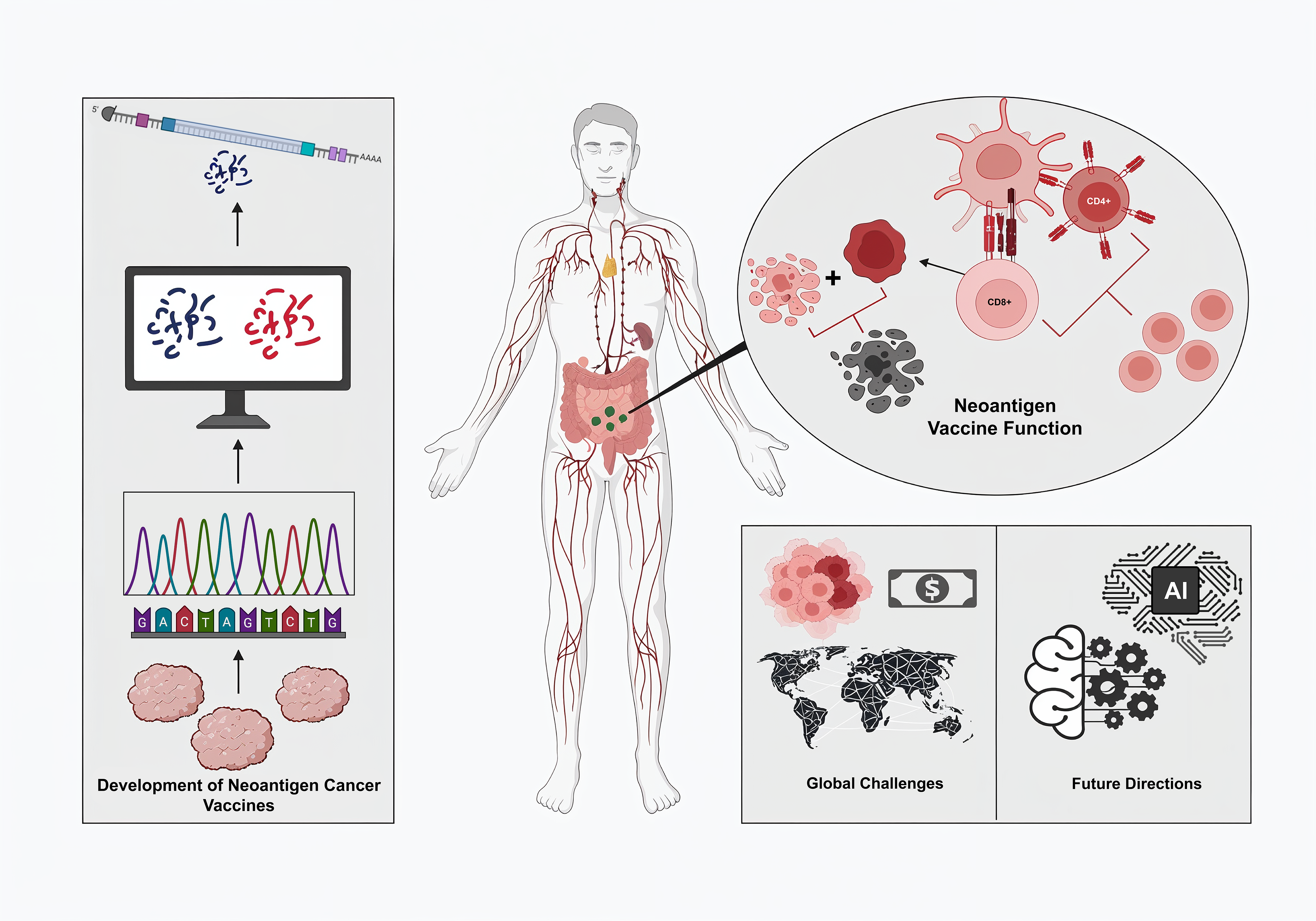 Neoantigen-Based Cancer Vaccines: Current Innovations, Challenges and Future Directions in Personalized Immunotherapy