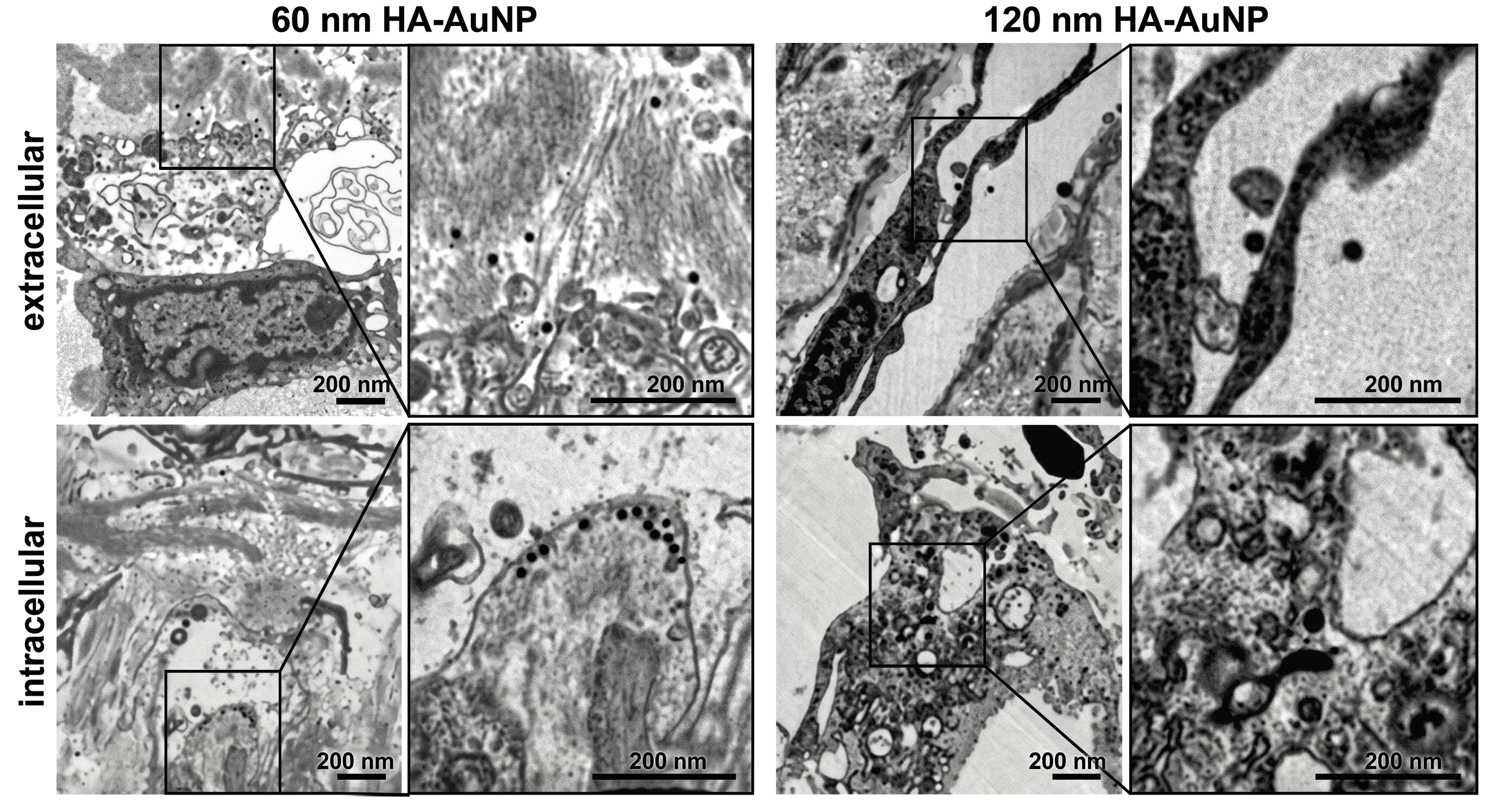 Figure 6: Distribution of gold nanoparticles within the trabecular meshwork after ex vivo perfusion with hyaluronic acid-coated gold nanoparticles (60 and 120 nm). Right-hand images are magnifications of the marked areas of the left-hand images; scale bars = 1 µm. Reproduced from Ref. [50] (under the license of CC BY 4.0).