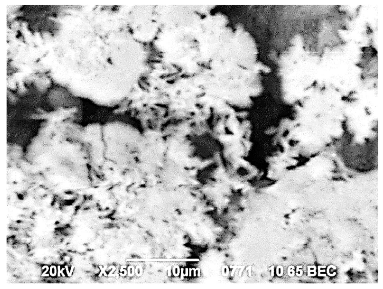 Figure 4: The process of hydration with the formation of crystal hydrates in Trioxident in the apical part of the root canal. SEM. VES. Magnification: ×2500.