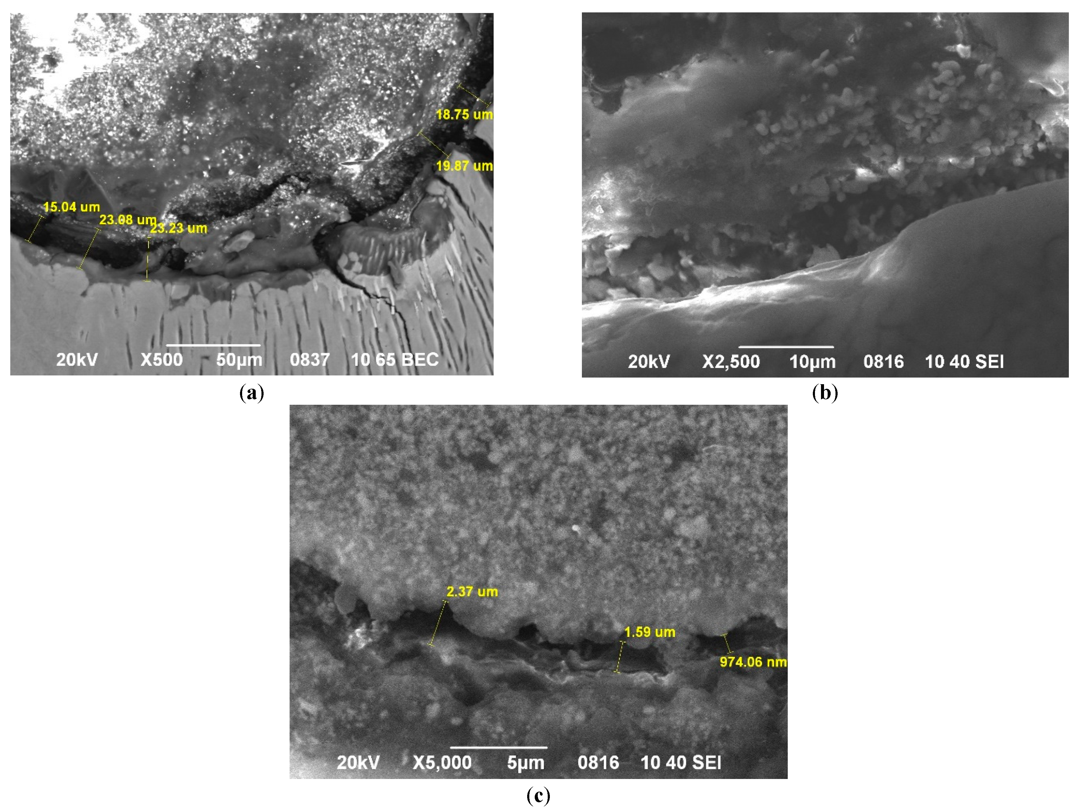 Figure 7: Micro gap between the canal wall and the filling material under study: Foredent (a), Sealapex (b), Trioxident (c). SEM. Contrast in BEC (a) and SEI electrons (b,c). Magnification: ×1000 (a), ×2500 (b), ×5000 (c).