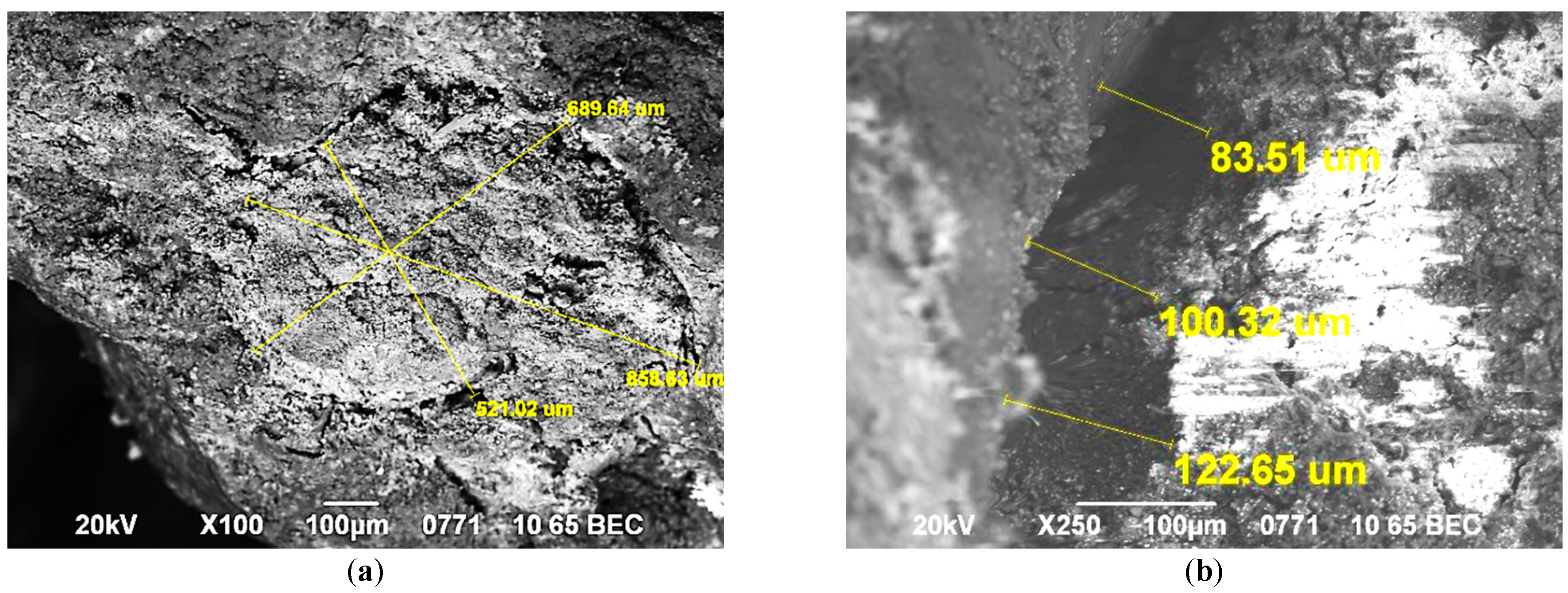 Figure 9: View of the apical part of the root after filling (a). Micro gap between the canal wall and the Foredent filling material on the outer surface of the root (b). SEM. VES. Magnification: ×100 (a), 250 (b).
