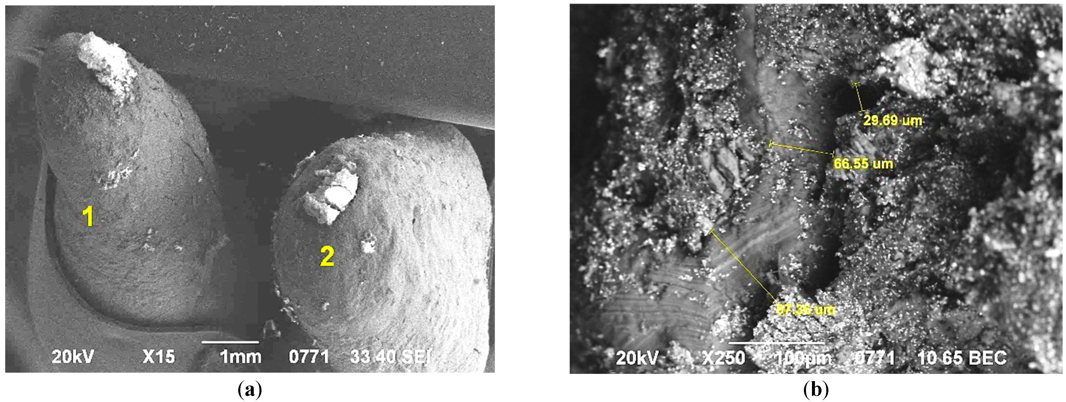 Figure 10: View of the apical part of the root after filling (a). Micro gap between the canal wall and the filling material Sealapex with gutta-percha pins on the outer surface of the root (b). SEM. SEI and BEC. Magnification: ×15 (a), ×250 (b).