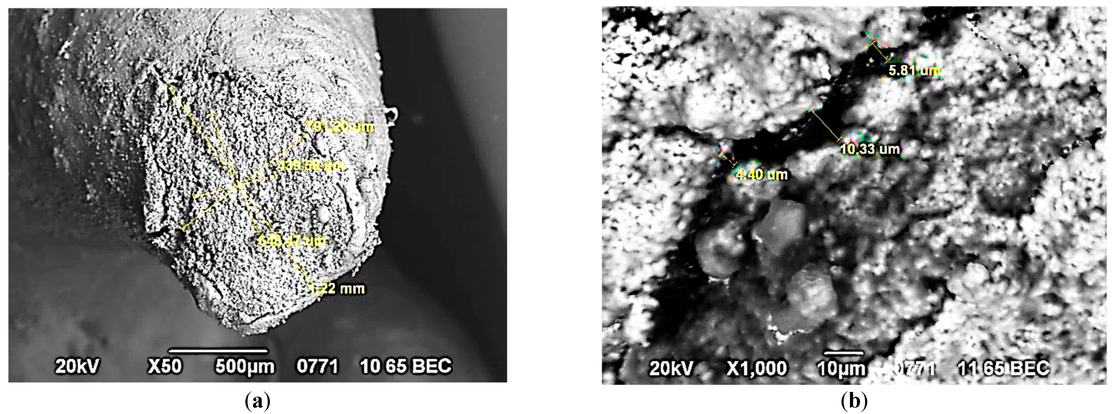 Figure 11: View of the apical part of the root after filling (a). Micro gap between the canal wall and the Trioxident filling material on the outer surface of the root (b). SEM. VES. Magnification: ×50 (a), ×1000 (b).
