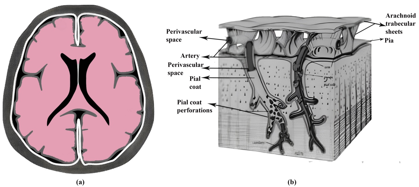 Figure 1: (a) The falx in the interhemispheric fissure, the tentorium between the cerebellum, the vermis, and the occipital lobes, and the inner table of the skull are regions in the diagram where dura-arachnoid augmentation could be present. Pure dural augmentation cannot fill sulci or basilar cisterns without pial or subarachnoid involvement. (b) A schematic illustration of the brain leptomeninges, showing the subarachnoid space enclosed by the arachnoid mater and pia mater. The pia mater closely adheres to the brain surface and extends along vessels within the subarachnoid space. It enters the brain only along the perivascular regions of penetrating vessels.