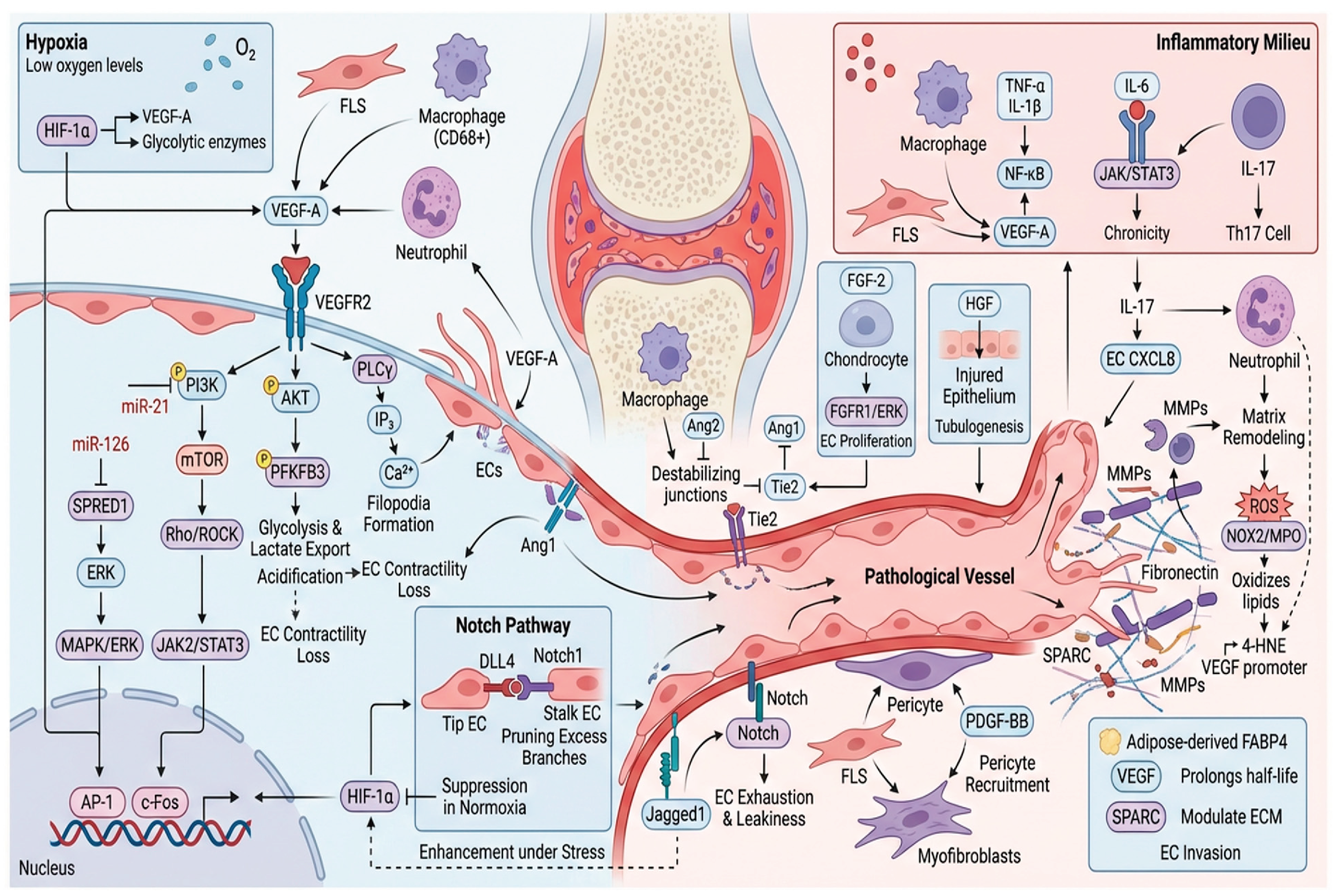 Figure 1: Integrated molecular and cellular mechanisms of angiogenesis in rheumatoid arthritis (RA): Hypoxia-induced HIF-1α drives VEGF-A production from FLS and macrophages, activating VEGFR2 signaling in endothelial cells to promote sprouting. Pro-inflammatory cytokines (TNF-α, IL-1β, IL-6, IL-17) amplify angiogenesis via NF-κB and JAK/STAT3 pathways, while neutrophil-derived MMPs and ROS enable matrix remodeling. Angiopoietin imbalance (Ang2/Tie2) destabilizes vessels, and Notch signaling regulates branching and endothelial dysfunction. Metabolic reprogramming (PI3K/AKT/mTOR) and epigenetic factors further enhance pathological vessel formation, with pericyte recruitment and ECM modulators sustaining abnormal vasculature.