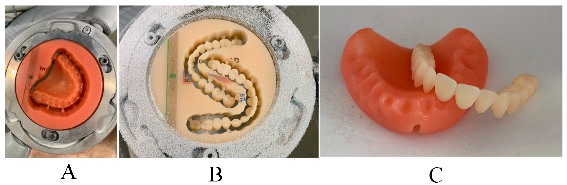 Figure 11: <p>Directly milled complete denture, (<strong>A</strong>) Milled denture base, (<strong>B</strong>) Milled denture teeth, (<strong>C</strong>) The finished denture base and teeth for maxillary complete denture [<a href="#ref190">190</a>].</p>
