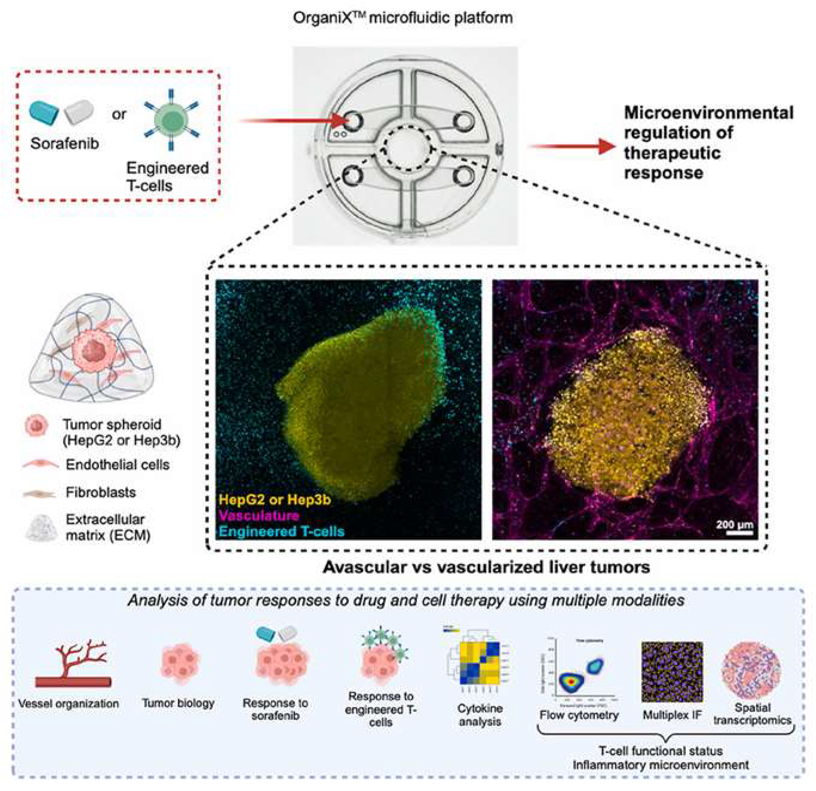 Figure 4: <p>Representation of the vascularized human liver tumor model based on a microfluidic platform, designed to test both drug and cell-based therapies (Reproduced from Vasudevan et al. (2025) [<a href="#ref35">35</a>] under the provisions of <a href="https://creativecommons.org/licenses/by/4.0/" target="_blank" rel="noopener noreferrer">https://creativecommons.org/licenses/by/4.0/</a> Copyright &copy; 2025 The Authors. Published by Elsevier Ltd. Access date: 11 May 2025).</p>
