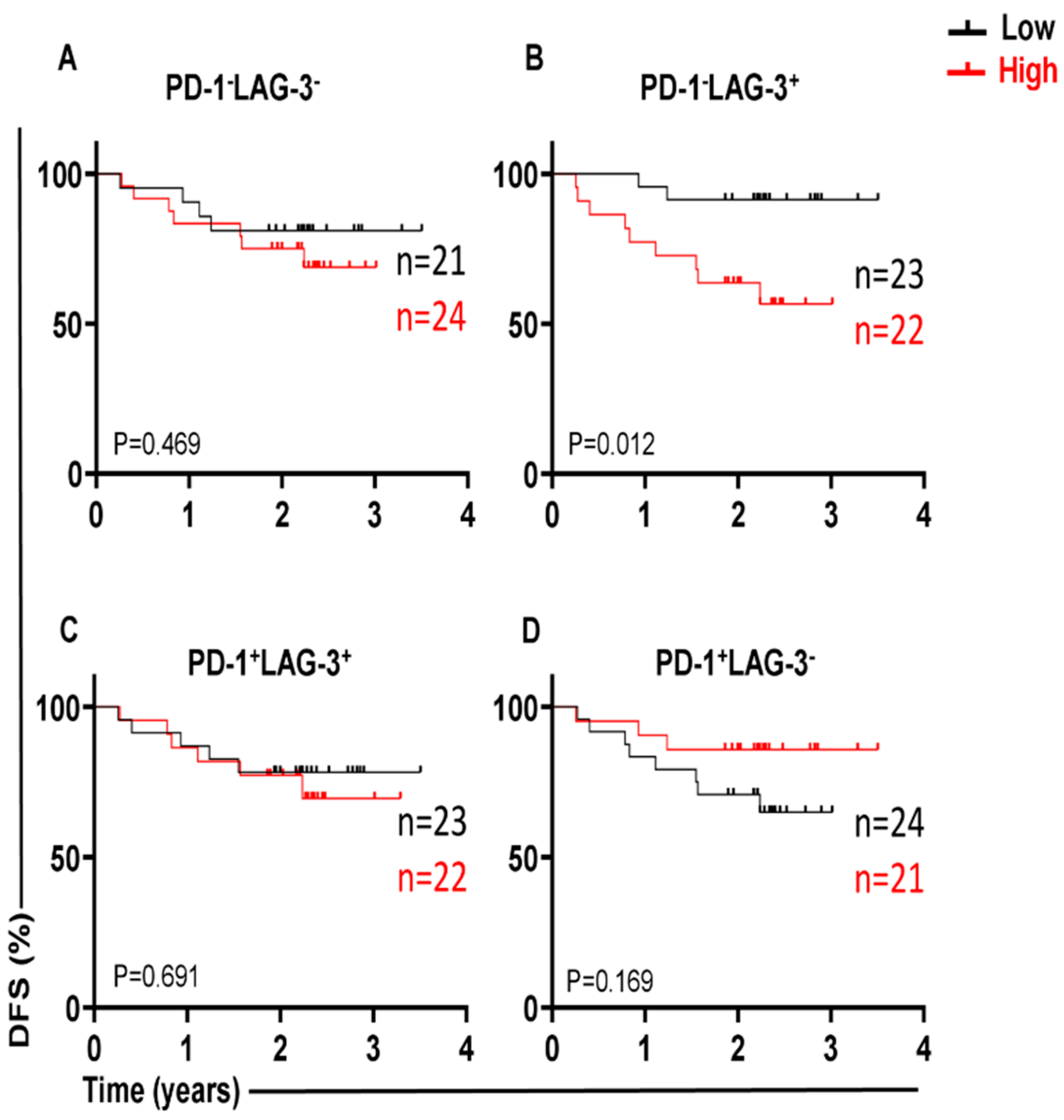 Figure 2: Kaplan–Meier curves of DFS based on the expression levels of PD-1 with LAG-3 in TILs. Tumor tissues with high percentages of PD-1−LAG-3− (A), PD-1−LAG-3+ (B), PD-1+ LAG-3+ (C), and PD-1+ LAG-3− (D) CD4+ TILs were compared to those with low levels of these ICs.