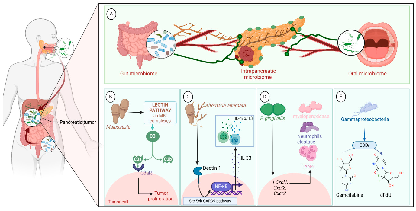 Figure 4: <p><strong>Microbiome Translocation to the Pancreas and Its Role in Pancreatic Tumor.</strong> (<strong>A</strong>) The pancreatic tumor microenvironment has a high abundance of gut and oral microbiomes. Due to the structural connection between the pancreas and the gastrointestinal tract, the microbiome can migrate to the pancreas, passing through the pancreatic duct or via blood or lymphatic vessels. Likewise, the oral microbiome can also colonize the pancreas in similar ways. (B-E) Intratumor microbiome plays different roles in proliferating pancreatic cancer and mediates resistance to therapy. (<strong>B</strong>) Fungi species such as <em>Malassezia</em> activate complement 3 (C3) cascades by binding to the mannose-binding lectin (MBL) through their cell wall glycans. C3 activation yields a complement factor (C3a) that activates the C3a receptor (C3aR), promoting cancer cell proliferation and supporting epithelial-to-mesenchymal transition. (<strong>C</strong>) Fungal components of <em>Malassezia</em> and <em>Alternaria alternata</em> activate the pattern recognition receptor, dectin-1. Consequently, the Src-Syk-CARD9-NFkB pathway is triggered and enhances the secretion of IL-33 from the pancreatic cancer cells that activate T<sub>H</sub>2 and ILC2 and promote tumor progression. (<strong>D</strong>) <em>P. gingivalis</em> induces the secretion of neutrophil chemokines (CXCL1 and CXCL2) in the tumor microenvironment, supporting the accumulation of tumor-associated neutrophil 2 (TAN2) and its proteases, including neutrophil elastase (NE) and myeloperoxidase, which contribute to higher pancreatic tumorigenesis via an unknown mechanism. (<strong>E</strong>) Gammaproteobacteria are linked to chemotherapeutic drug resistance. The bacterial enzyme cytidine deaminase (CDD<sub>L</sub>) metabolizes gemcitabine to its inactive form, 2&rsquo;,2&rsquo;-difluorodeoxyuridine (dFdU).</p>
