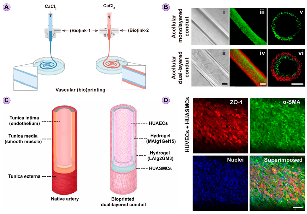 Figure 7: Microfluidic extrusion 3D bioprinting. (A) Schematics of microfluidic extrusion (bio)printing of monolayered and dual-layered vascular conduits. (B) Representative lateral-view bright-field (i,ii) and fluorescence microscopic images (iii,iv), and cross-sectional-view fluorescence microscopic images (v,vi) of mono-layered (top) and dual-layered (bottom) hollow tubes, respectively. Scale bars, 200 µm. (C) Illustration of structures of the native artery and printed arterial conduit. (D) Fluorescence confocal images of the immunostained artery exhibiting expressions of ZO-1 by human umbilical artery endothelial cells (HUAECs) and α-SMA by human umbilical artery smooth muscle cells (HUASMCs). The cells were counterstained with DAPI for nuclei. Red, ZO-1; green, α-SMA; blue, nuclei. Scale bars, 100 µm. Reproduced, with permission from [48].
